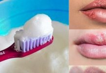 Does Toothpaste help Cold Sores? Home Remedies Can Help Does Toothpaste help Cold Sores