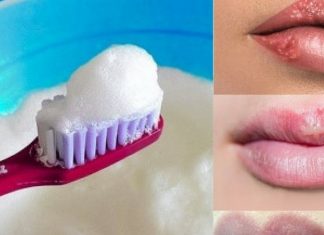 Does Toothpaste help Cold Sores? Home Remedies Can Help Does Toothpaste help Cold Sores
