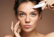 How to get rid of acne spots? rid of acne spots